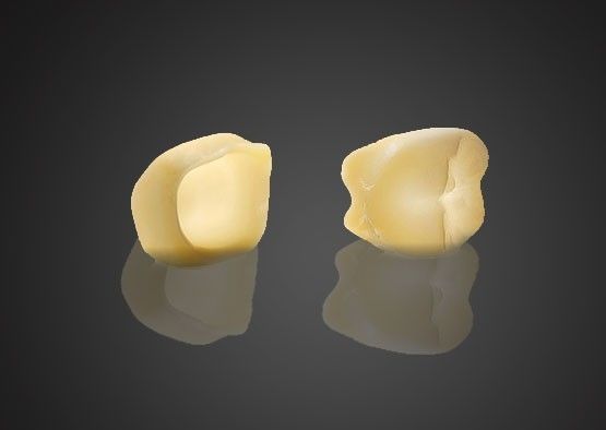 주문 1440 Mpa 높은 안정성 3M 라바 미적 지르코니아 후쪽 치아에 맞춤형 온라인 제조