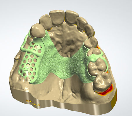 주문 디지털 금속 프레임 CAD CAM 치과 디자인 3D 프린팅과 함께 코크 재료 온라인 제조