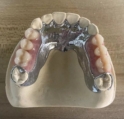 고강도 주사기 금속 부분 치아 3D 프린팅으로