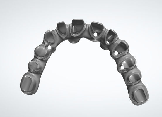 치과 연구실 왕관 치과 CAD CAM 시스템 치아 복원을 위해 사용자 정의