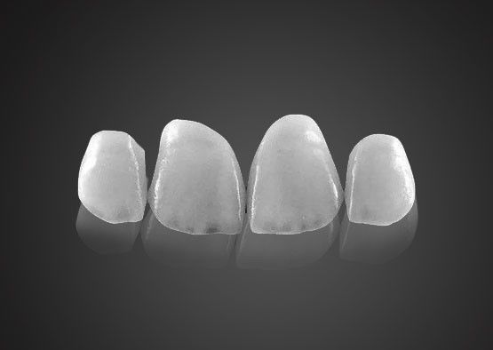 IPS 0.2mm 초 얇은 Emax 장단 고 강도와 함께 얼룩 저항
