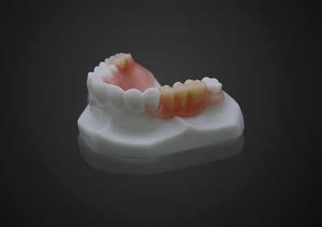 가볍고 편안한 발플라스트 부분 치아 가공이 쉬워 투명성 높다