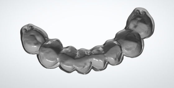 밀드 에그 셸 CAD CAM 치아 디자인 PMMA 임시 브릿지 임플란트