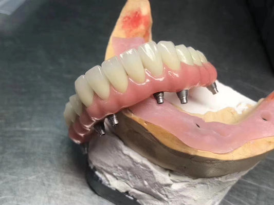 이름